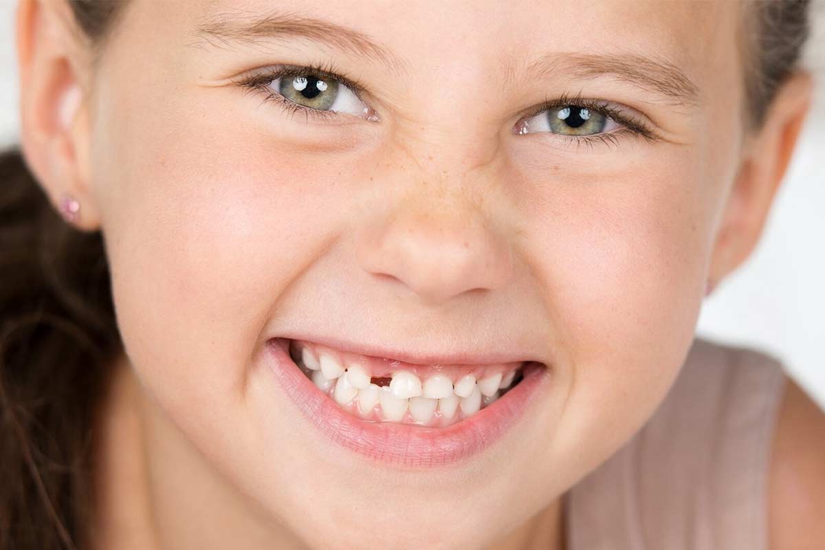 رویکردهای جدید ارتودنسی در ناهنجاری‌های میکرو‌دنتیا و هیپو‌دنتیا