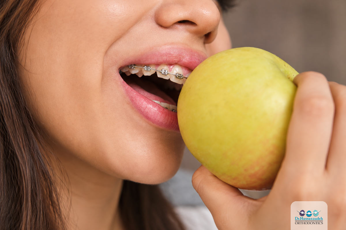 ۱۰ اشتباه رایج بعد از ارتودنسی؛ چه کارهایی نباید انجام دهیم؟